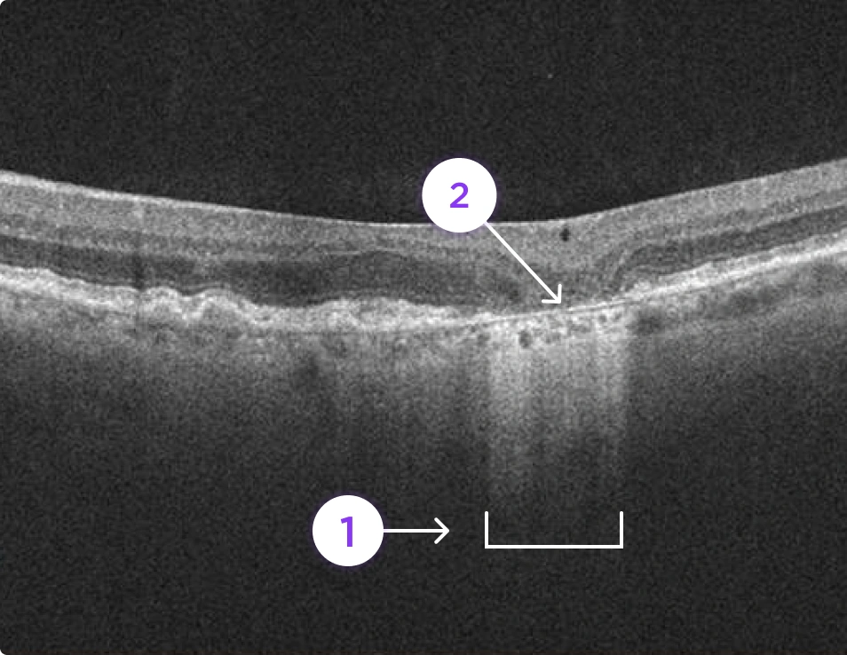 Optical Coherence Tomography